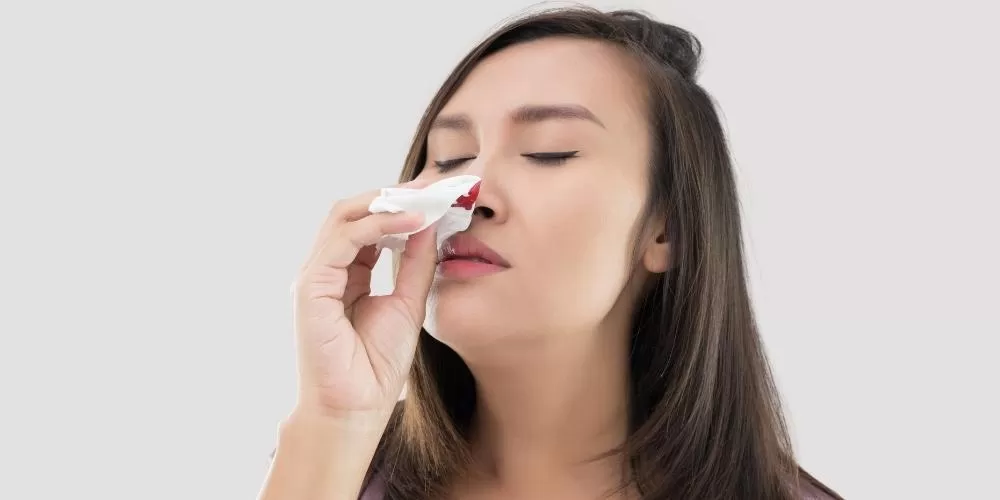 What Causes Nosebleeds?